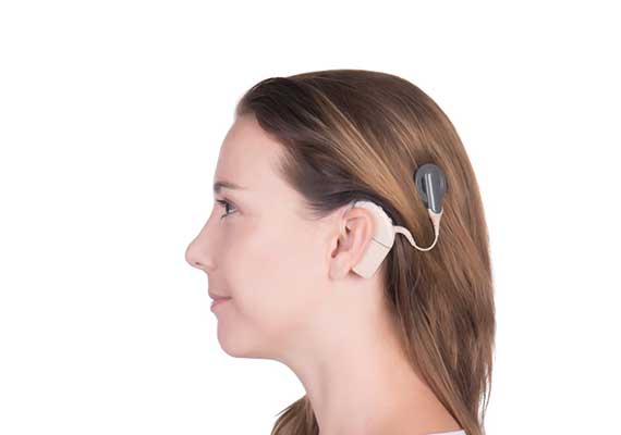 Female-Patient-Fitted-with-a-Cochlear-Implant
