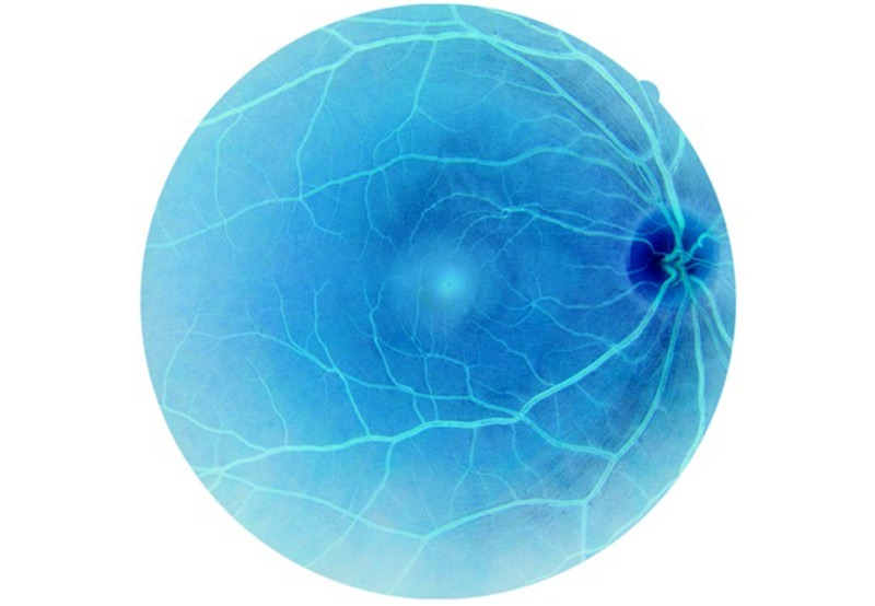 3D-Rendering-of-the-Human-Eye 3D-Rendering-of-the-Human-Eye