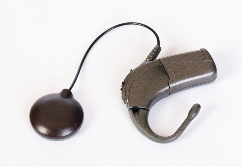 Dark-Colored-Cochlear-Implant