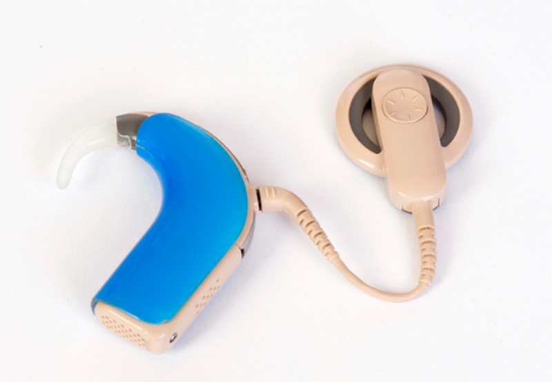 Light-Beige-and-Blue-Colored-Cochlear-Implant